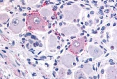 Immunohistochemistry-Paraffin: VRL1 Antibody [NBP3-14516]